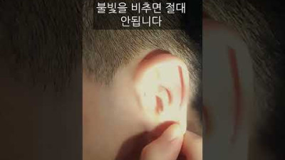 귓속에 바퀴벌레 들어간 순간 대처법 (불빛 비추면 큰일납니다) 소름주의!