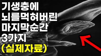(실제)기생충에 먹혀버린 뇌 / 믿기힘든 마지막순간 TOP3