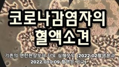 코로나 감염상태 5일차 혈액소견